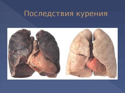 Последствия курения для здоровья человека