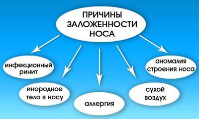 Причины насморка у взрослых - лечение, что делать если постоянный