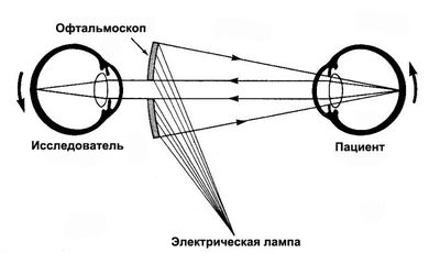 Принцип офтальмоскопии