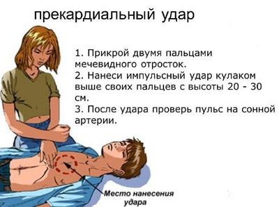 Прекардиальный удар
