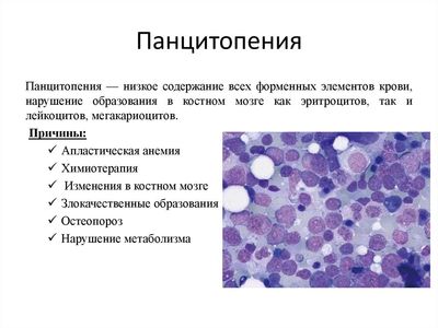 Панцитопения