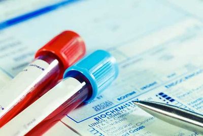 Расшифровка количественного анализа на вирус гепатита С