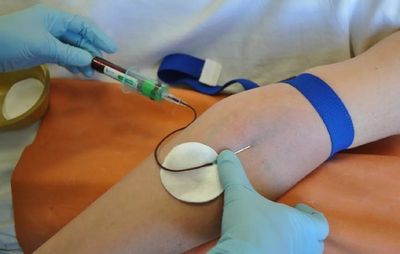 Расшифровка количественного анализа вируса гепатита С