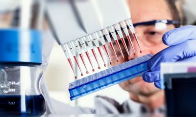 Вирус гепатита С – количественный анализ
