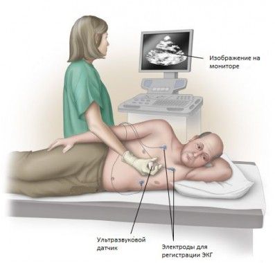 Некоторые данные расшифровки результатов УЗИ сердца