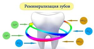 реминерализация зубов