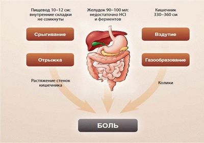 Метеоризм