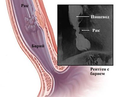 Рентгенография