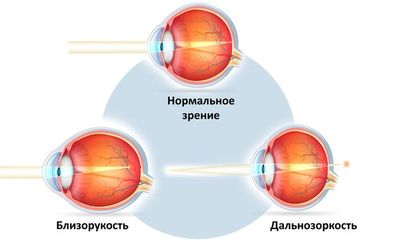 Виды и эффективность использования таблиц для проверки зрения