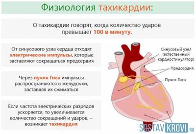 Причины