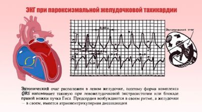 Схема 3