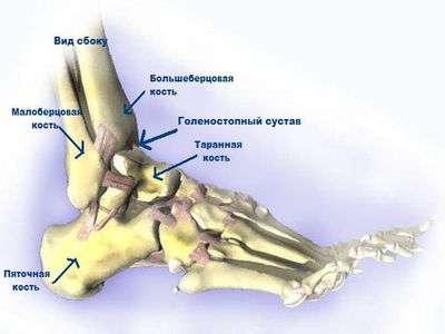 Схематический рисунок