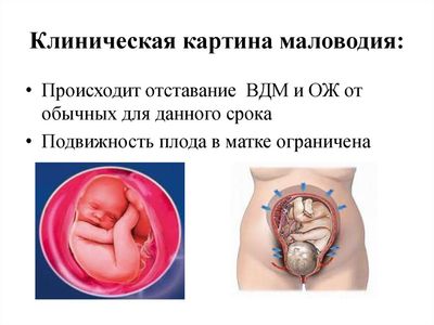 Маловодие