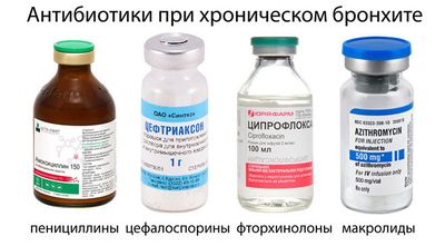 Антибиотики при бронхите