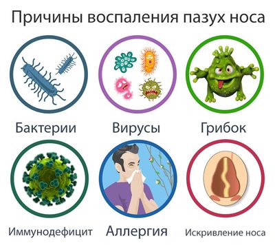 Из-за чего бывают воспаления
