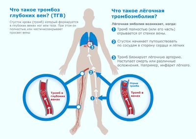 Викасол при месячных