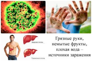 Что такое вирусный гепатит, его симптомы и методы лечения