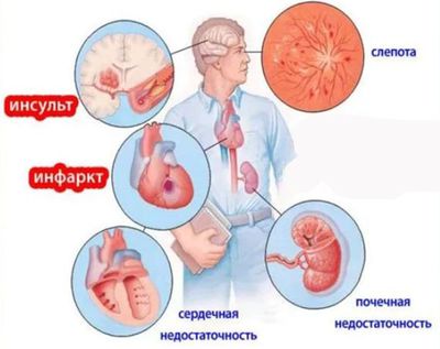 осложнения АГ