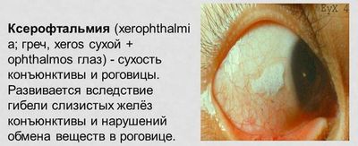 Выбираем витамины для здоровья глаз