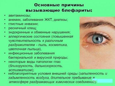 Воспаление на веке глаза - что делать, как и чем лечить, если покраснело и опухло