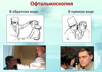 Прямая и непрямая офтальмоскопия